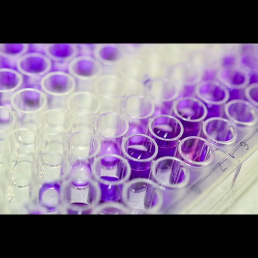 [0399-CSB-E13064B-96T] Bovine Cortisol ELISA Kit size: 96 Tests